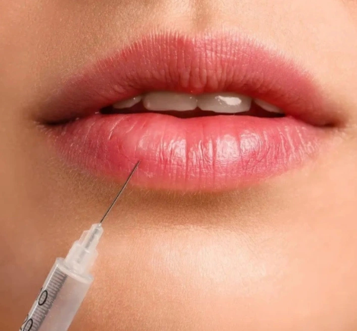 Lip Enlargement IMAGE main service page